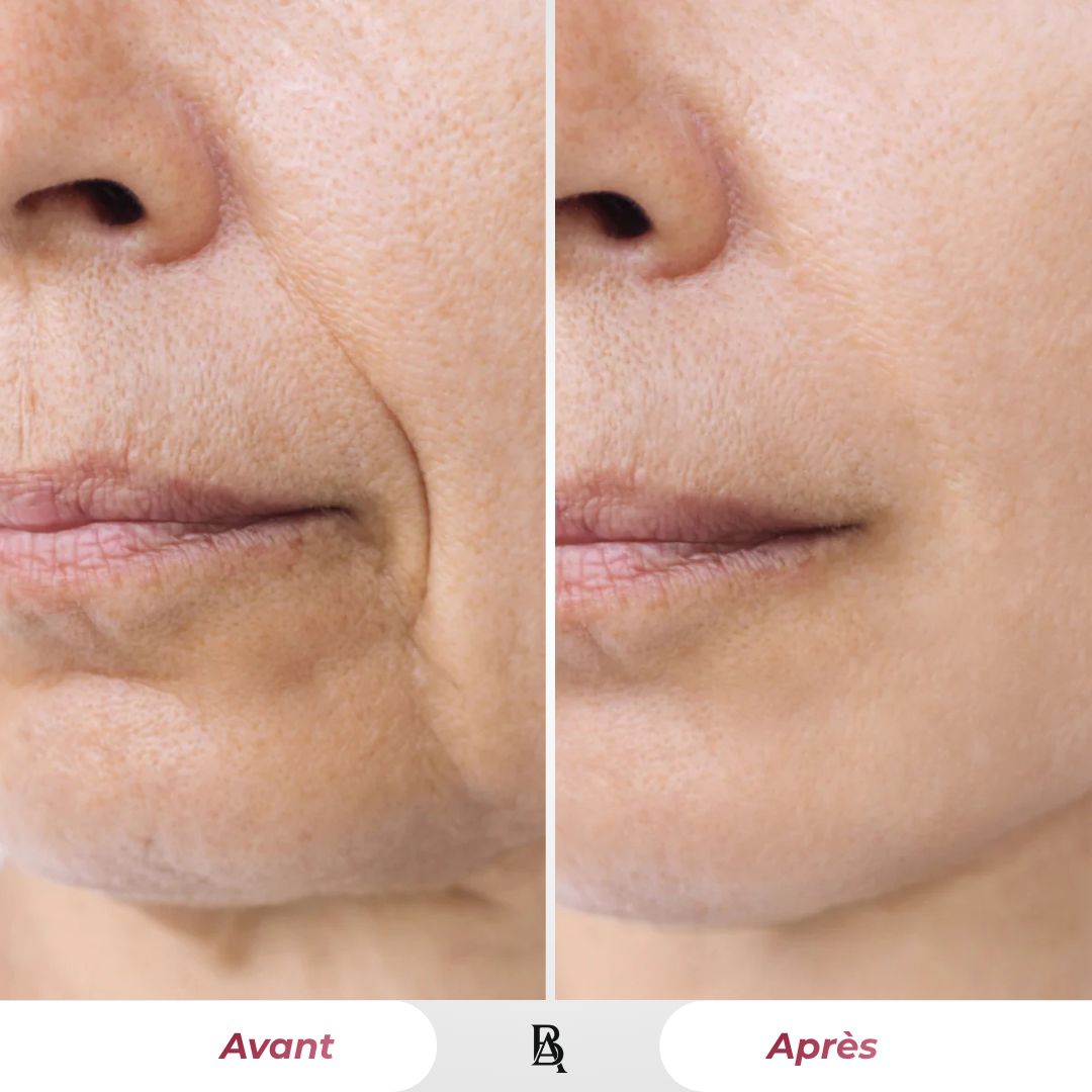 Masque Bio-Collagène – Peau Repulpée & Lumineuse